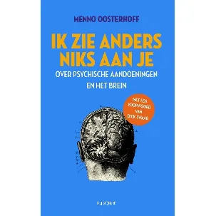 Afbeelding van Ik zie anders niks aan je