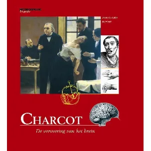 Afbeelding van Charcot