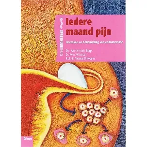 Afbeelding van Iedere maand pijn